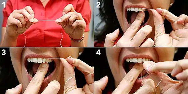 Proper Flossing